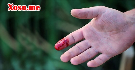 Chiêm bao thấy bị thương đánh con gì?