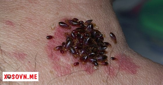 Mơ thấy bị rệp cắn là có người muốn đẩy mình vào nguy hiểm 